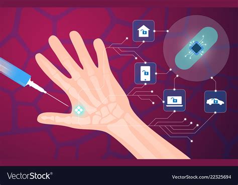 the human rfid chip png|Microchip implant (human) .